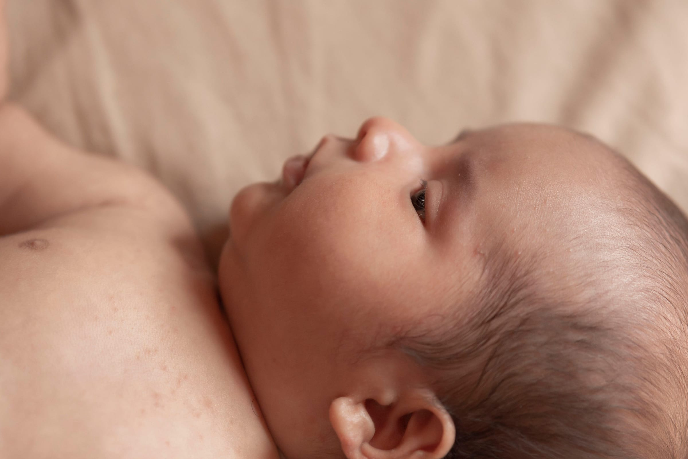 Flat Head (Plagiocephaly) at Ease Family Chiropractic in Petaling Jaya