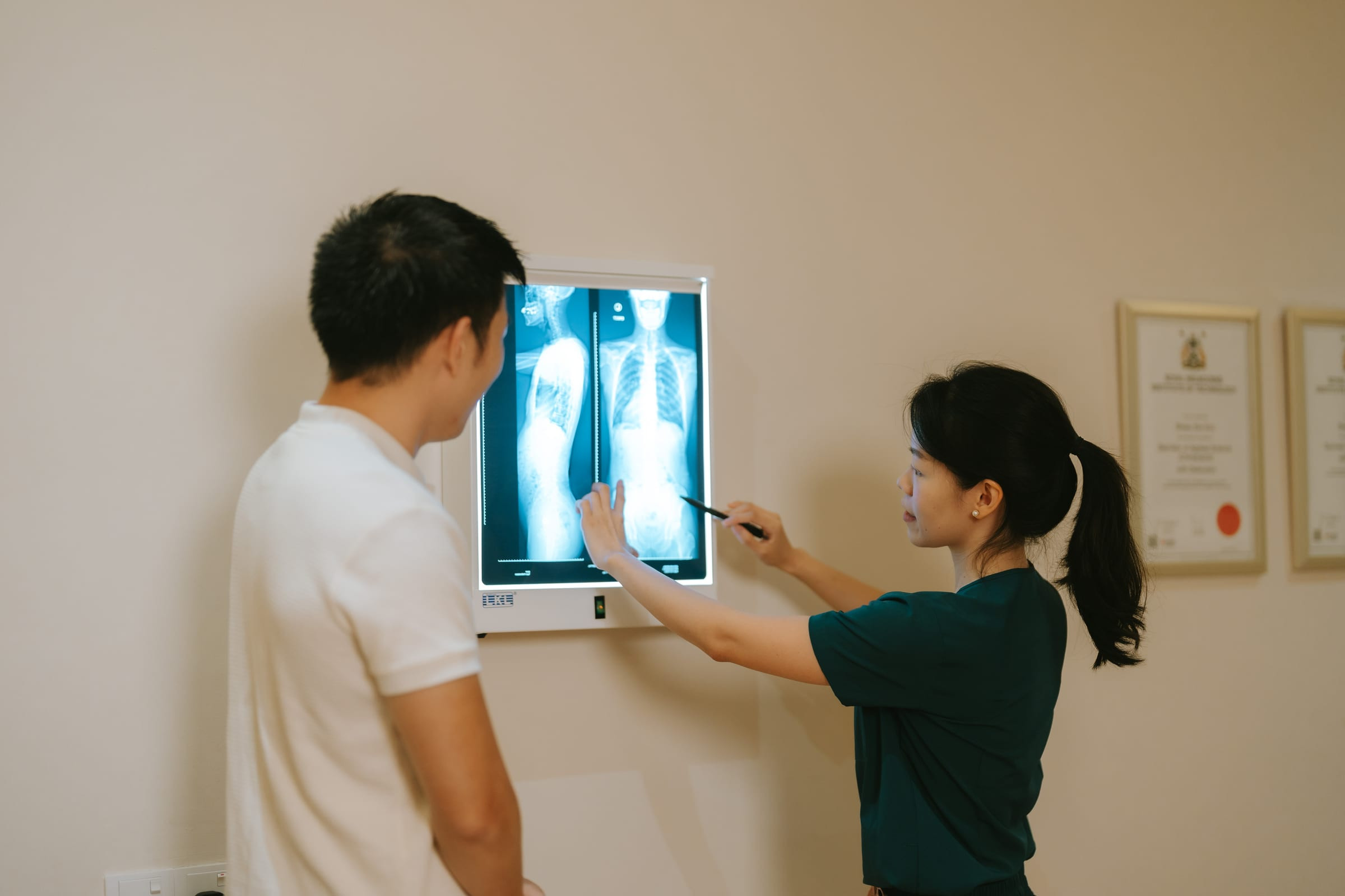 Chiropractor reviewing a spinal X-ray showing scoliosis with a patient at Ease Family Chiropractic